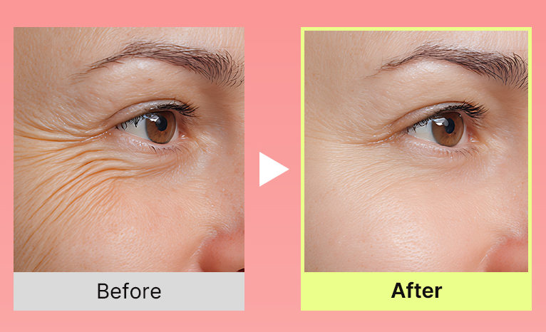 Celnive Wrinkle Bounce Multi Balm
