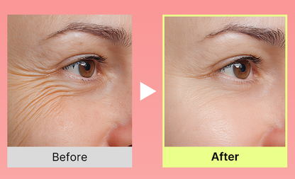 Celnive Wrinkle Bounce Multi Balm