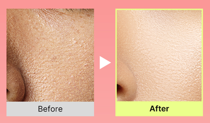 Celnive Wrinkle Bounce Multi Balm