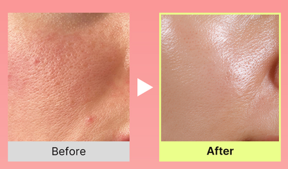 Celnive Wrinkle Bounce Multi Balm